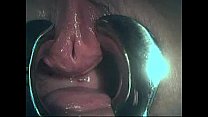 video bdsm指マンの尿道 sex