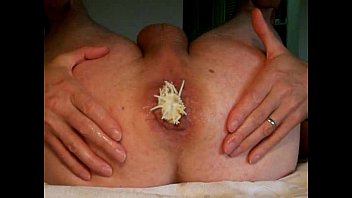 video アナル拳おもちゃ挿入ギャップお尻遊びanaldehnerass hole extrem gay men sex