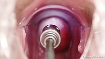 video ホットブロンドベイビー膣検査と浣腸 sex