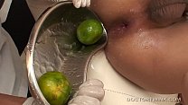 video извращенные медицинские фетиши азиатки не играющие в гольф sex