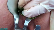 video イラクサ尻フィスティングアナル挿入イラクサと検鏡 sex