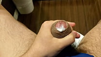 video мастурбация крайней плоти которую не удалось остановить sex