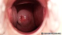 video クリニックでのナースザネタ検鏡オナニー sex