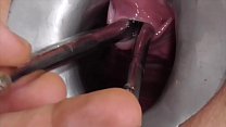 video любитель freyjaanalslut multiple sounds джеймс растягивает уретру фрейи множеством звуков писает в зияющую пизду sex