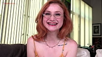 video смотри на брекеты как рыжая милая девушка скарлет скайс сосет член sex